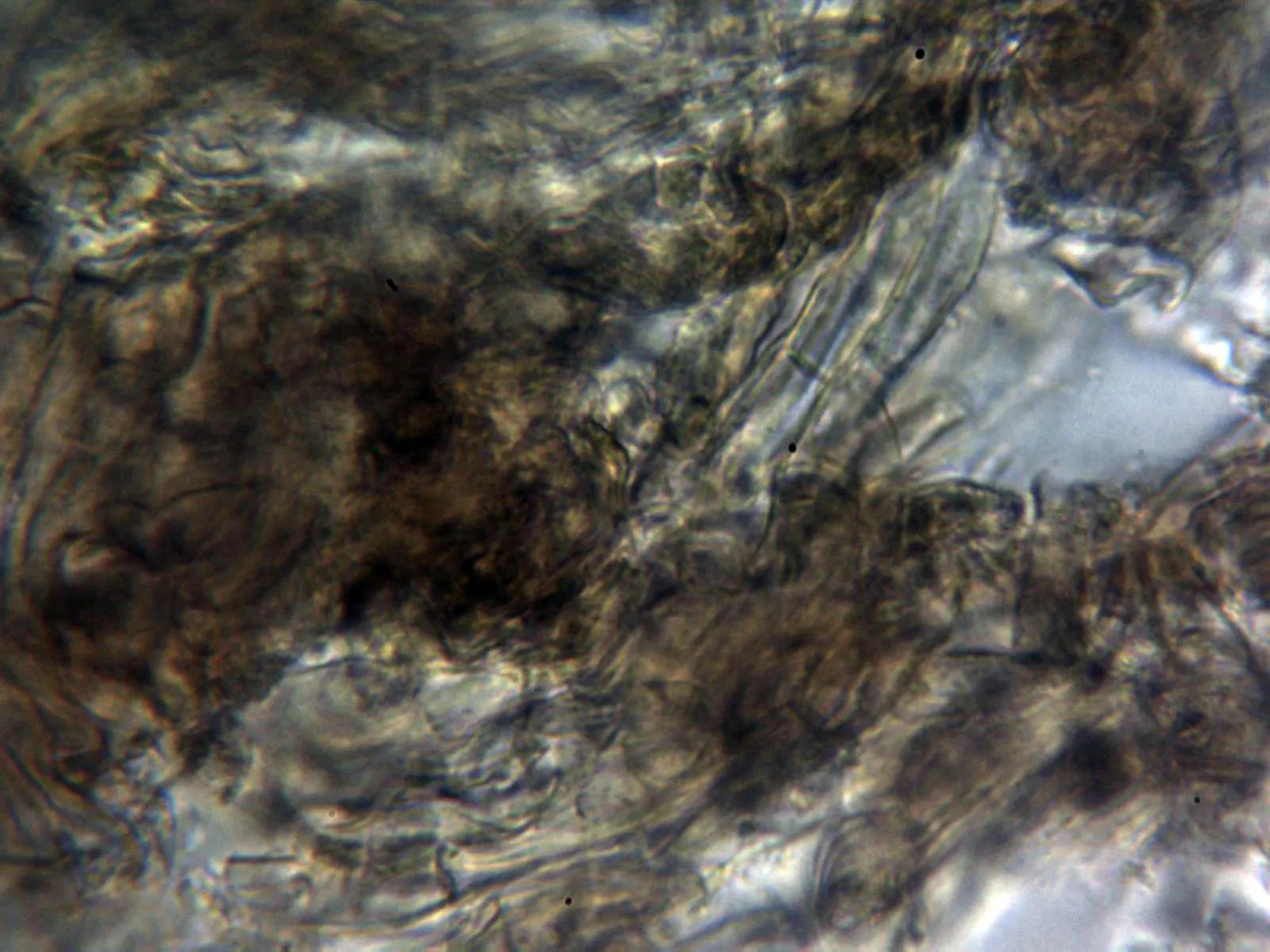 Microscopía de Sarcodon squamosus - 10 - Cutícula